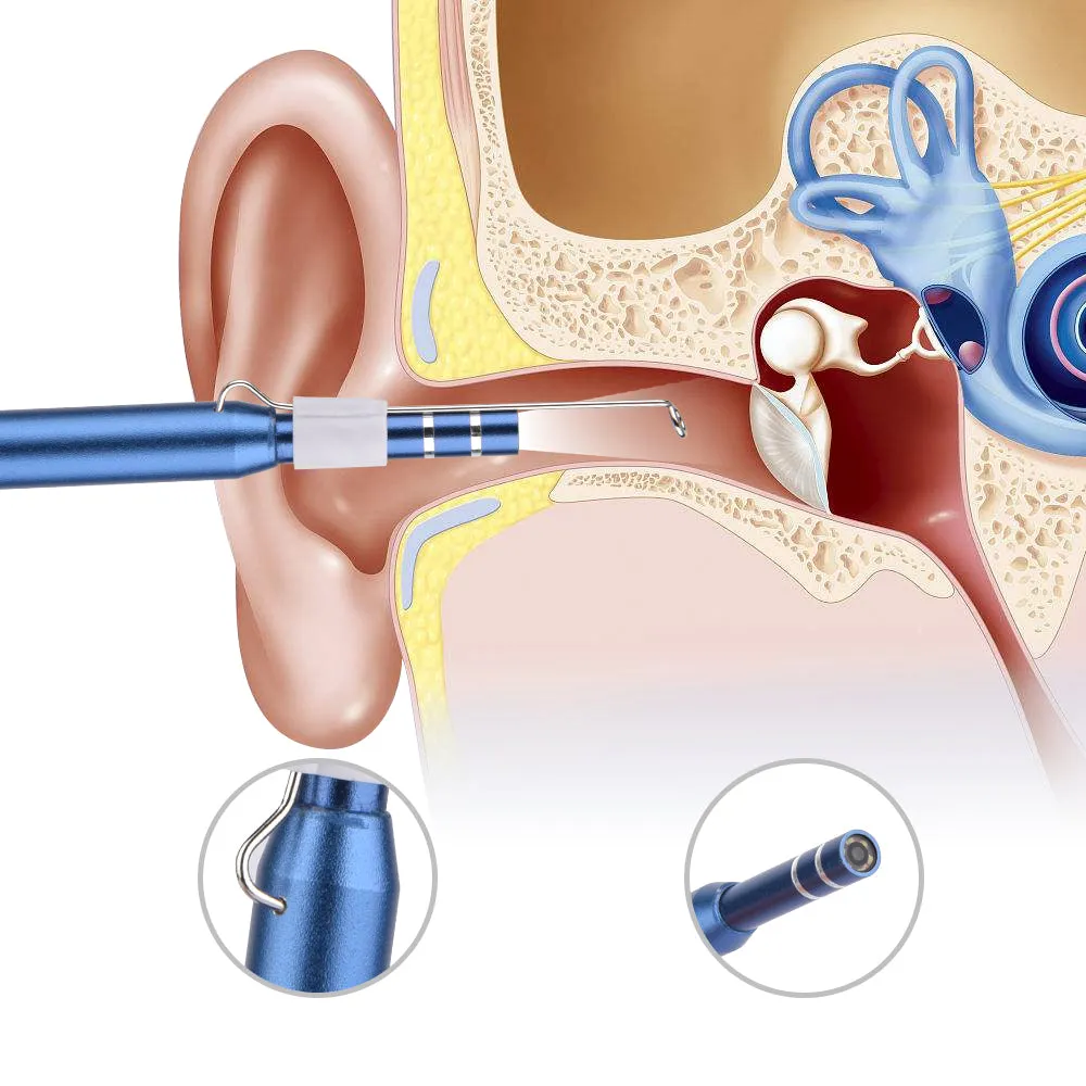 Ear Cleaning Earpick Otoscope 1.3 MP Endoscope With 3 Types USB Connectivity