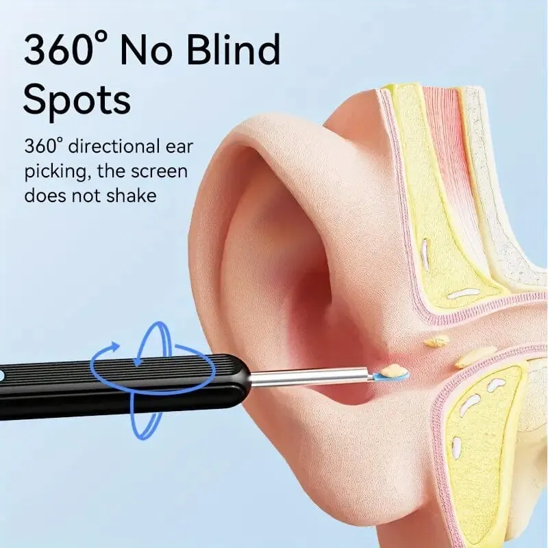 Ear Wax Removal Kit with Camera, Light and 6 Ear Spoons